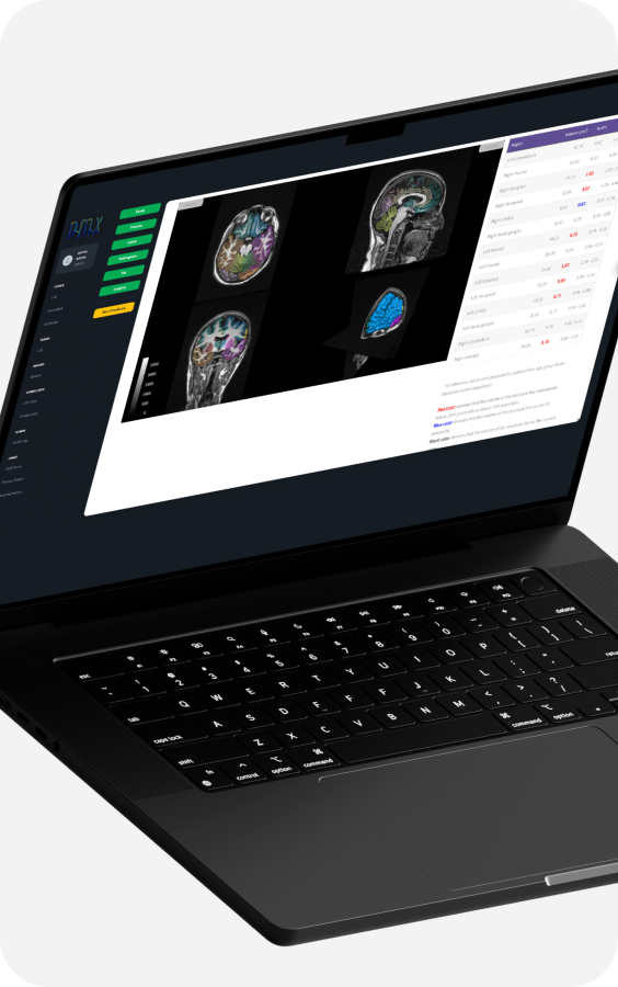 MRI Analysis 2